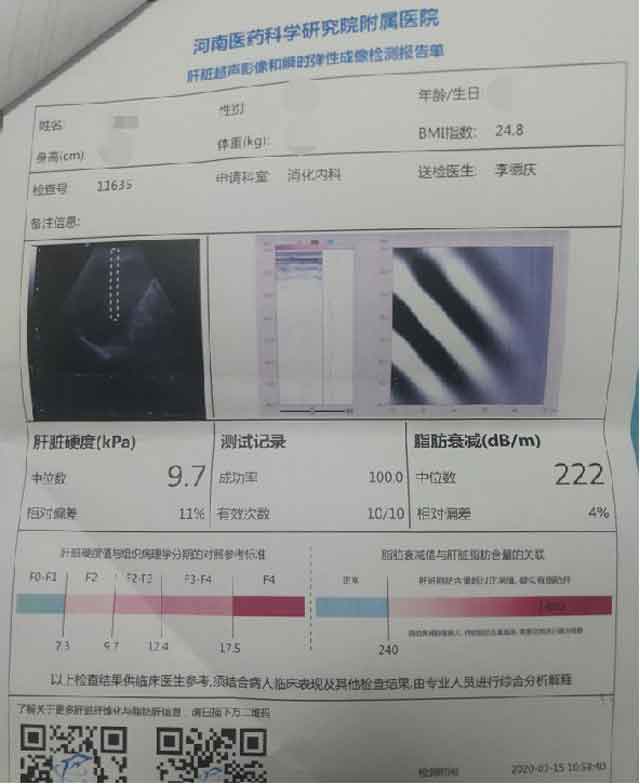 郑州哪家医院看肝硬化好?郑州肝硬化哪个医院好